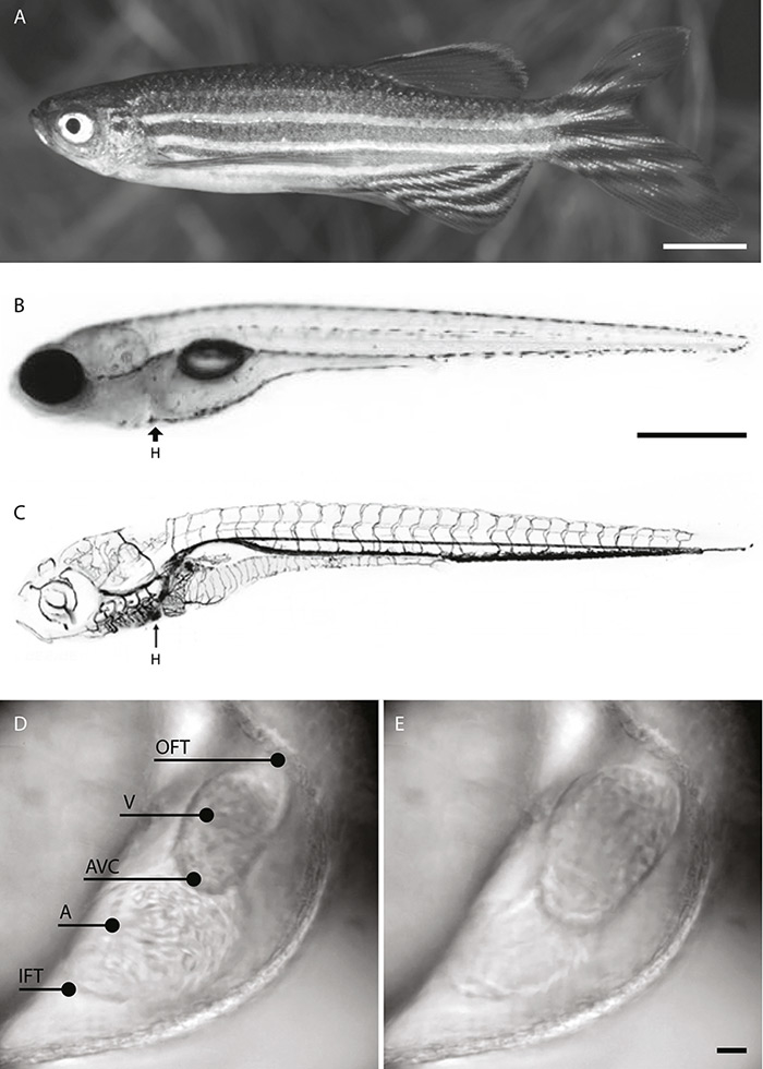 In vivo imaging of cardiac development and function in zebrafish using